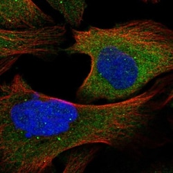 TAX1BP1 Antibody, Novus Biologicals 0.1mL; Unlabeled:Antibodies, Polyclonal
